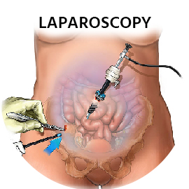 Best Gastro Doctor in Ahmedabad, Gastrointestinal Surgery in Ahmedabad