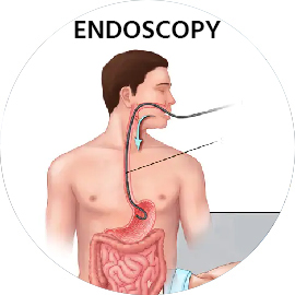 Gastrointestinal Surgery in Rajasthan, G I Surgeon in Rajasthan