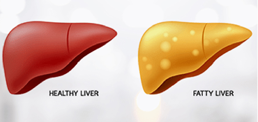 Liver Specialist Doctor in Ahmedabad, Liver Physician Doctor in Ahmedabad, liver specialist doctor near me, liver doctor in ahmedabad, best liver doctor in ahmedabad, liver hospital in ahmedabad, best liver hospital in ahmedabad, best liver specialist doctor in ahmedabad, liver surgeon in ahmedabad, best liver doctor near me, liver specialist doctor near me