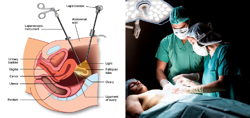 Therapeutic Endoscopy in Gujarat